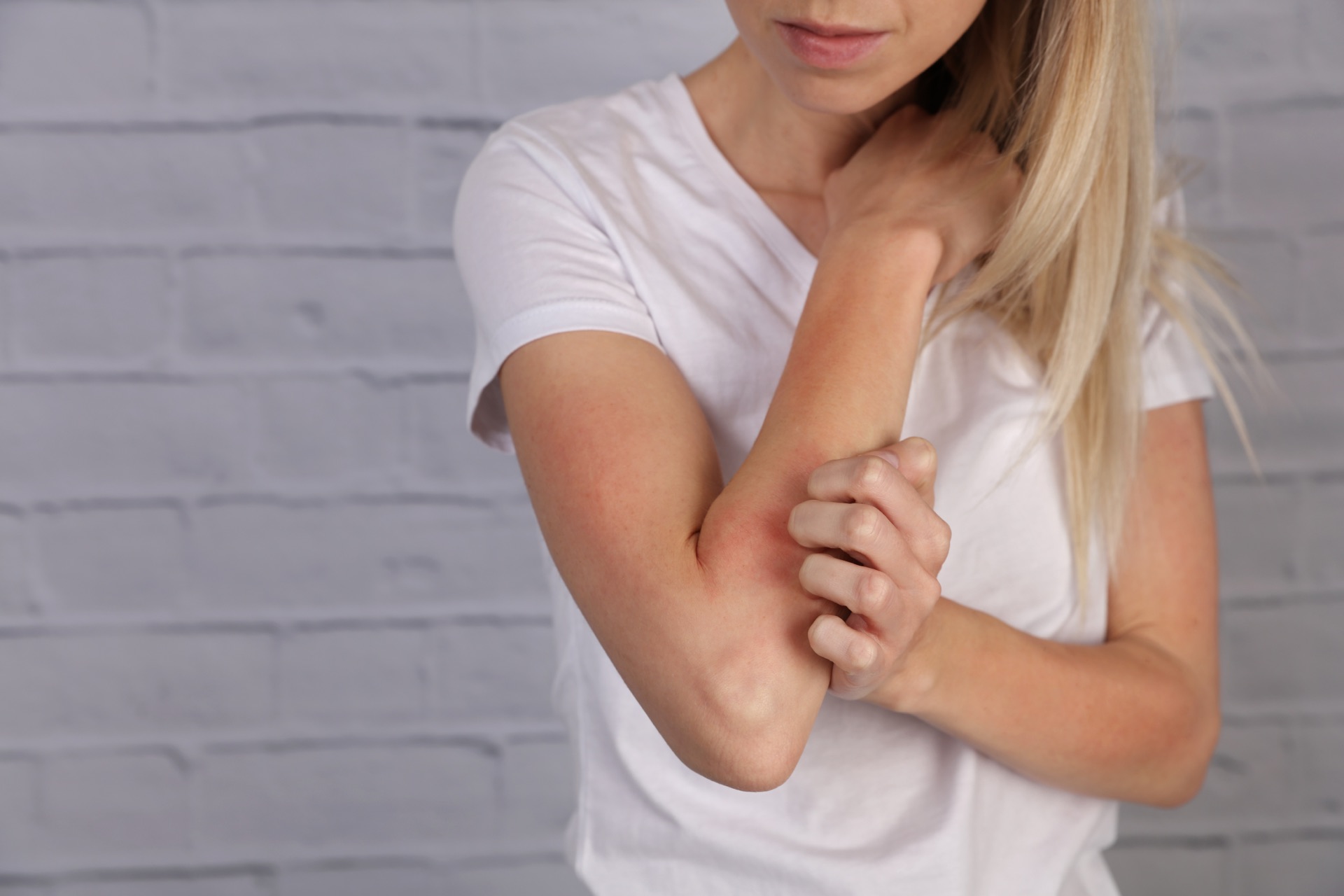 Skin irritation flare-ups from hard chlorinated tap water
